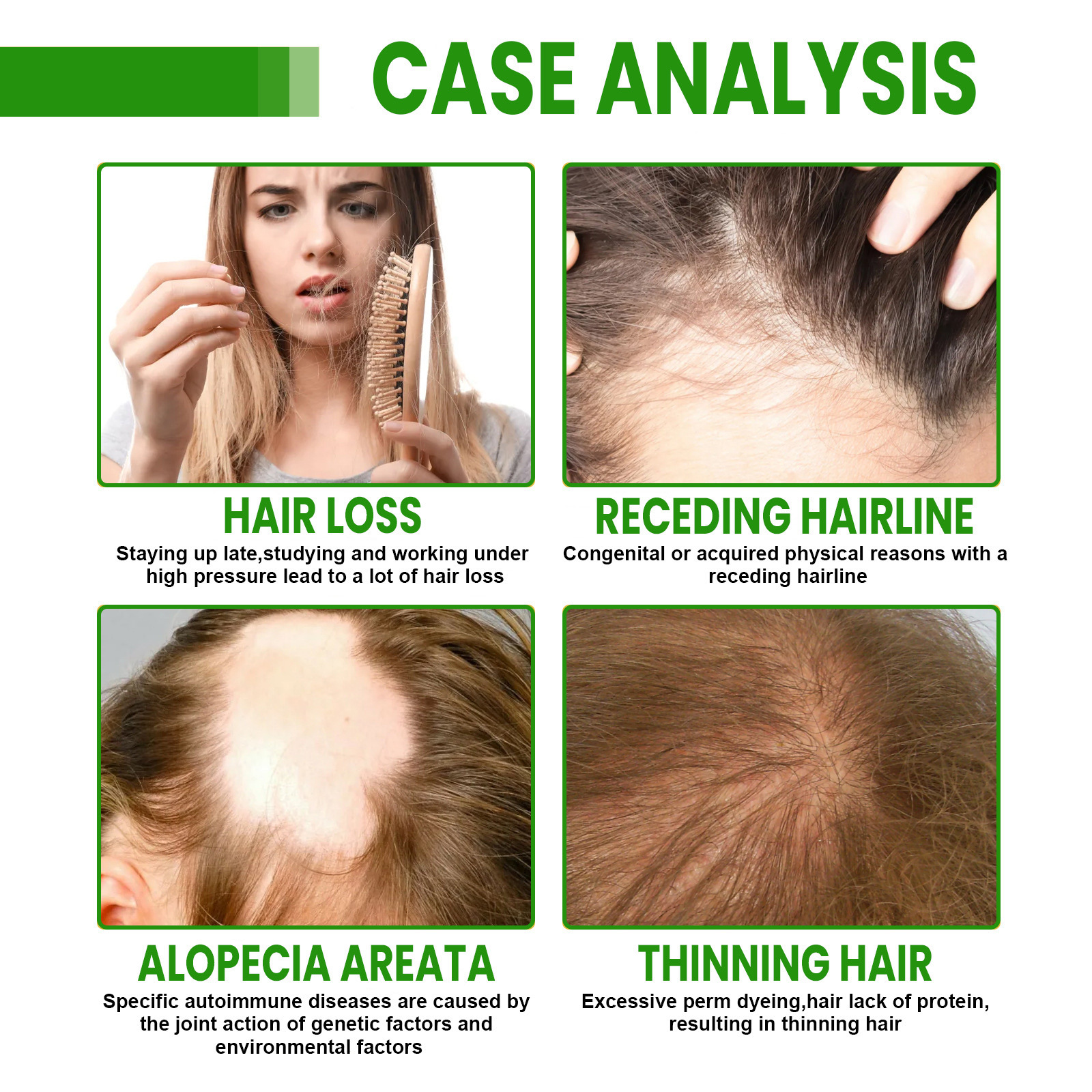 Hair Growth Oil Spray Repair D - Plant Growth Regulator 评论和价格